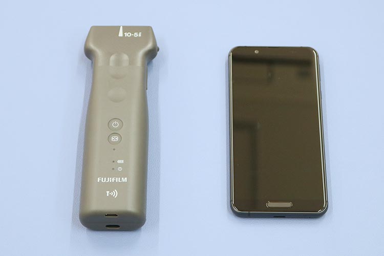 超音波画像診断装置